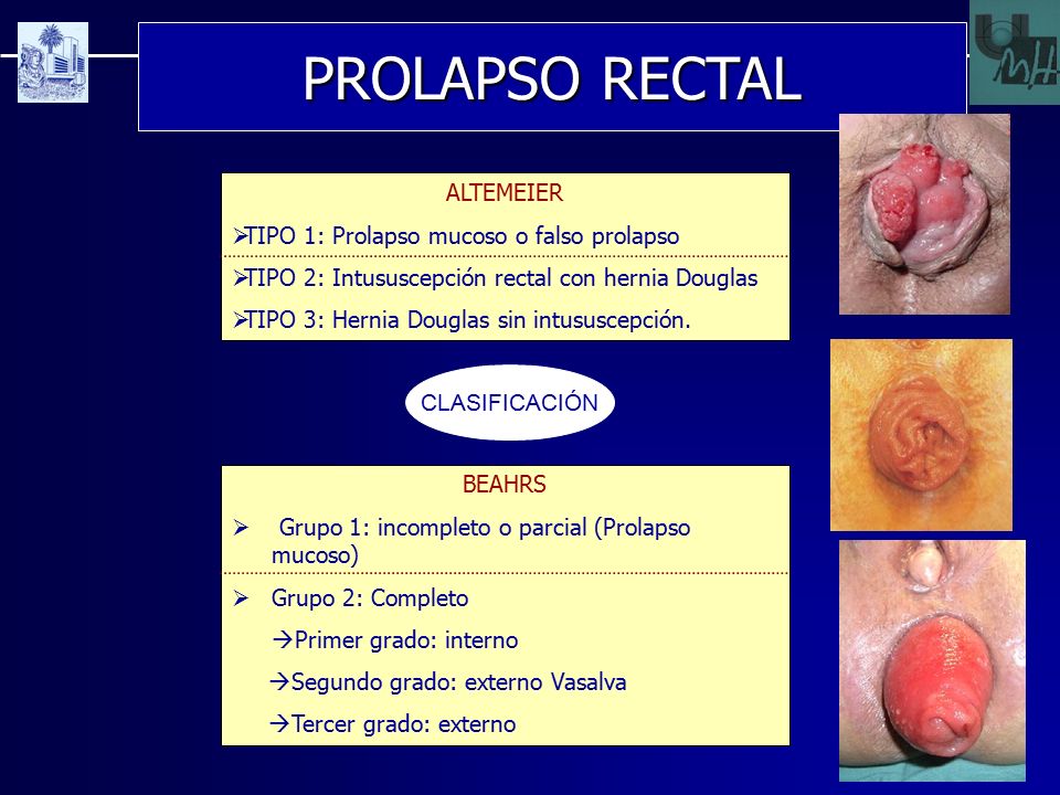 tratamiento de prolapso rectal en perros